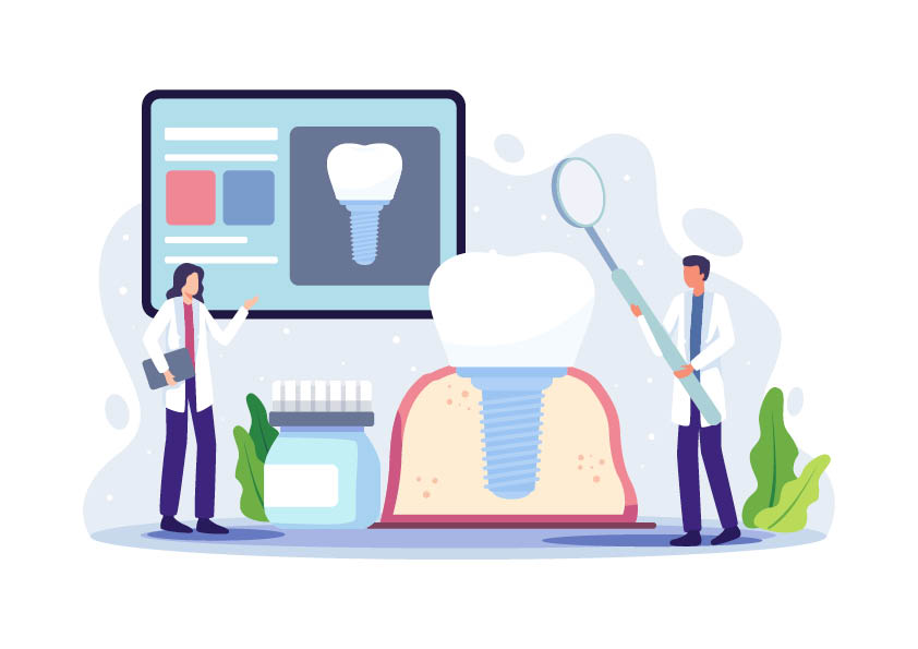 Why dental Implants differ