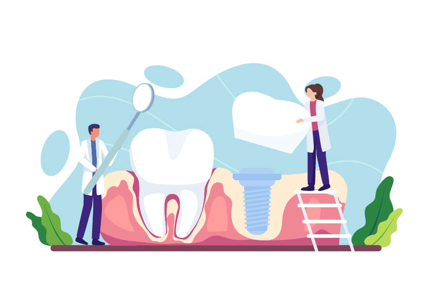 The Benefits of Dental Implantology